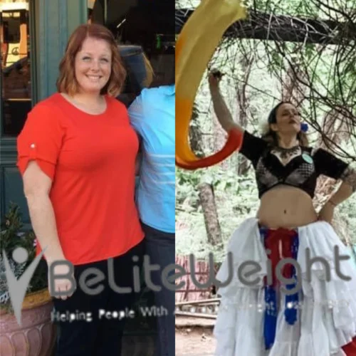 Weight Loss Surgery Gastric Sleeve before and after